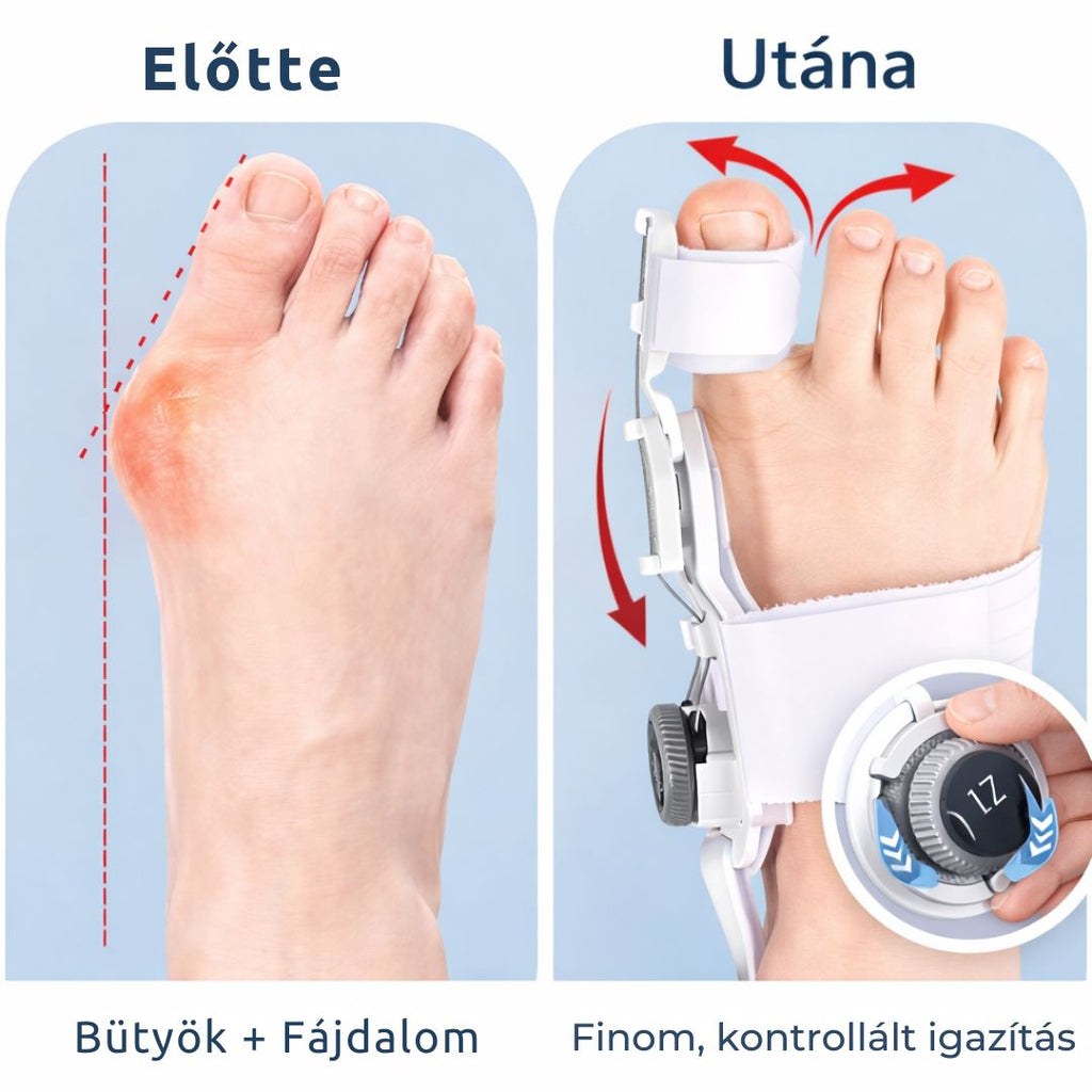 OrthoFlex Éjszakai Bütyök Korrektor